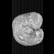 coronal slice image map