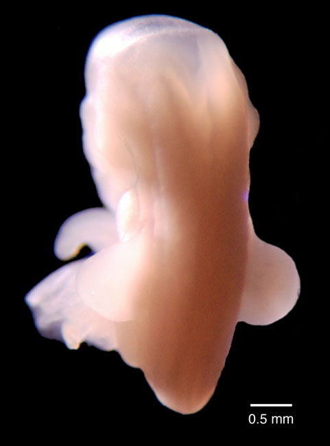 human embryo photograph