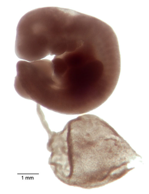 human embryo photograph