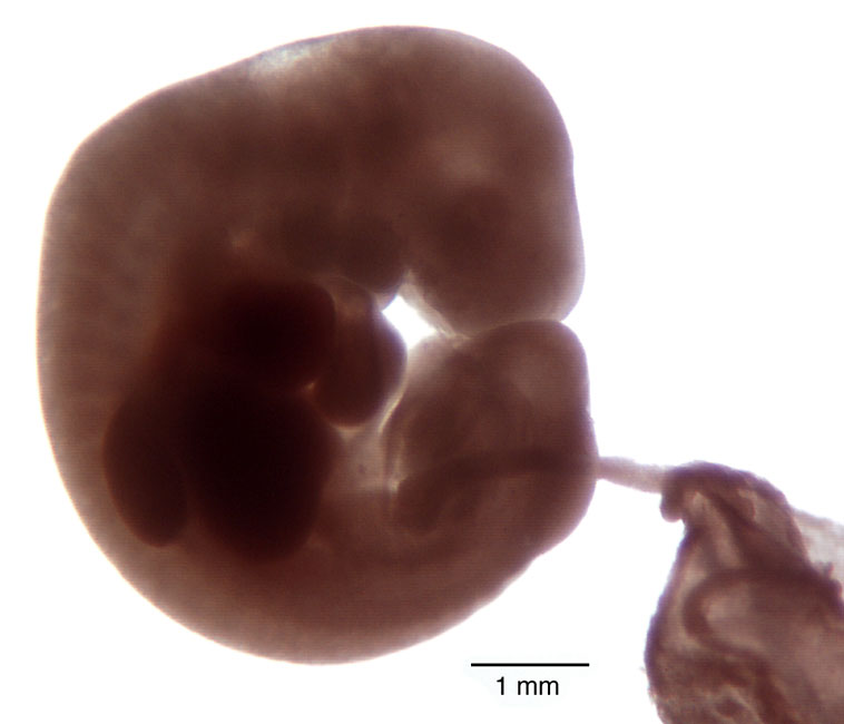 human embryo photograph