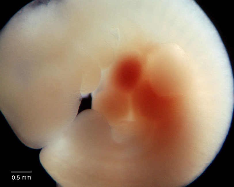 human embryo photograph