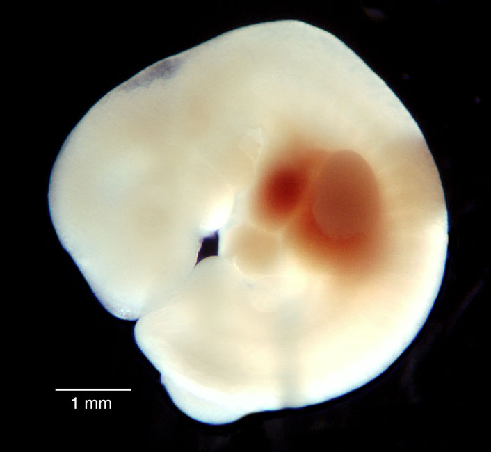 human embryo photograph