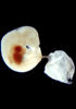 day 28 human embryo photograph