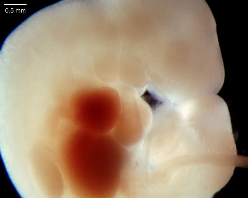 human embryo photograph