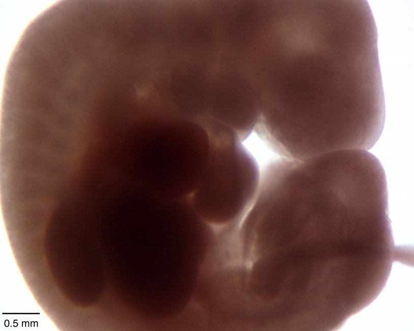 human embryo photograph