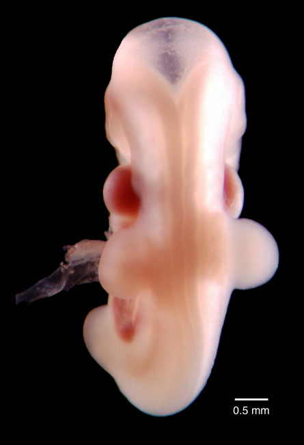 human embryo photograph