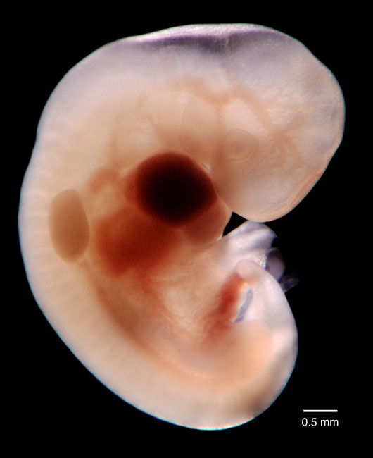 human embryo photograph