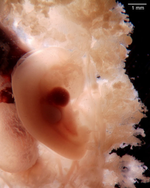 human embryo photograph