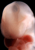 day 32 human embryo photograph