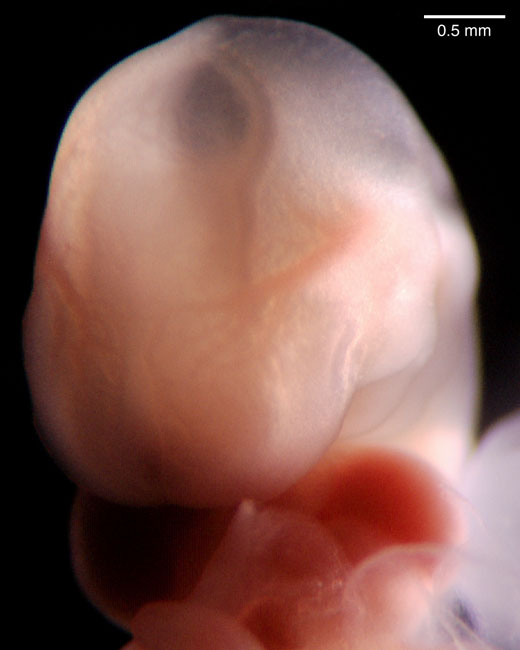 human embryo photograph