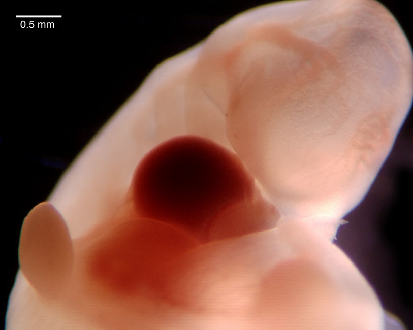 human embryo photograph