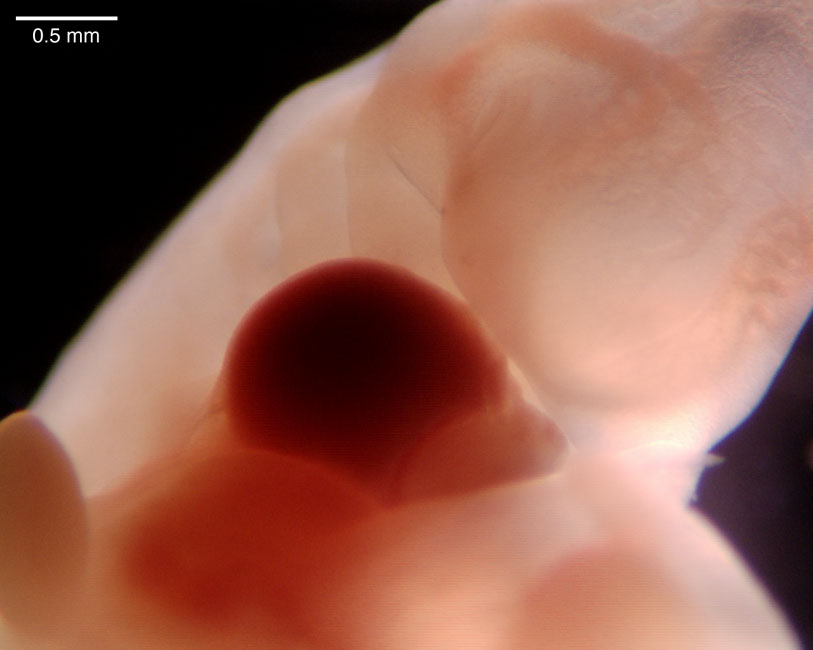 human embryo photograph