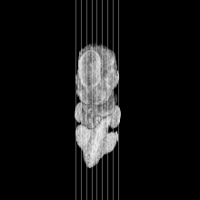 sagittal slice image map