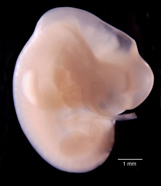 human embryo photograph