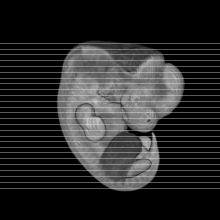 axial slice image map