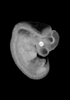 day 37 human embryo MRI animation