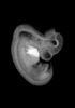 day 37 human embryo MRI animation