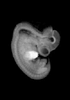 day 37 human embryo MRI animation