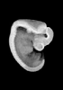 day 37 human embryo MRI animation