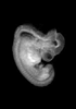 day 37 human embryo MRI animation