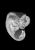 day 37 human embryo MRI animation