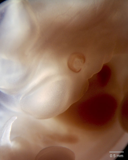 human embryo photograph