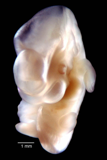 human embryo photograph