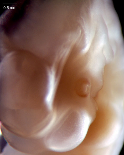 human embryo photograph