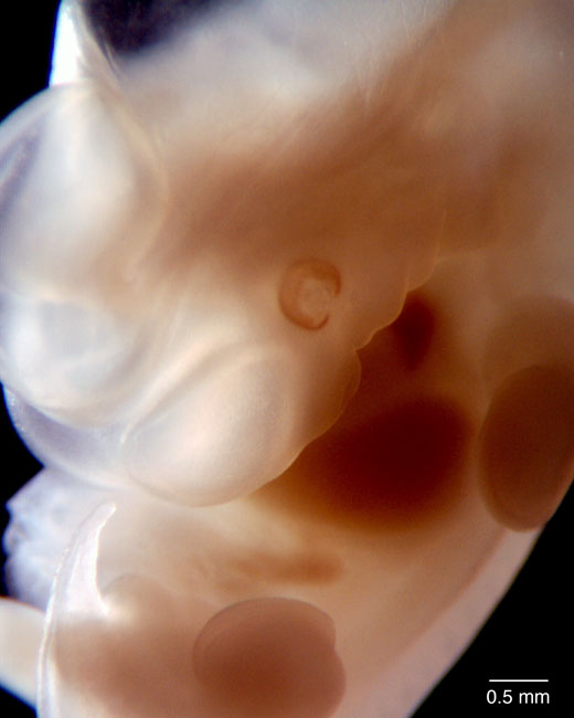 human embryo photograph