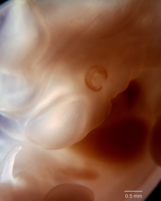 human embryo photograph