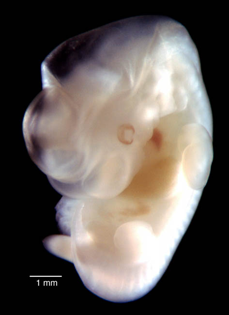 human embryo photograph