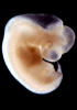 day 37 human embryo photograph