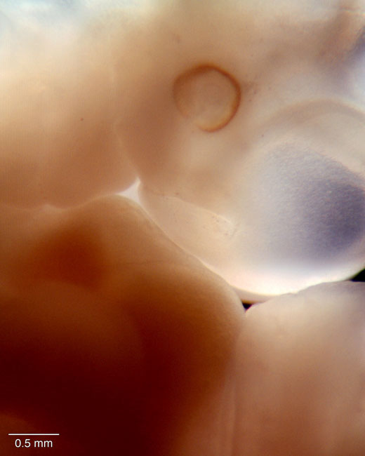 human embryo photograph