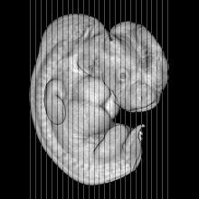 coronal slice image map