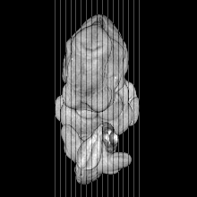 sagittal slice image map