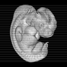 axial slice image map