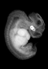 41 day human embryo - MRI animation