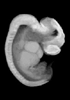 41 day human embryo - MRI animation