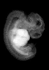 41 day human embryo - MRI animation