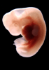 41 day human embryo - optical image