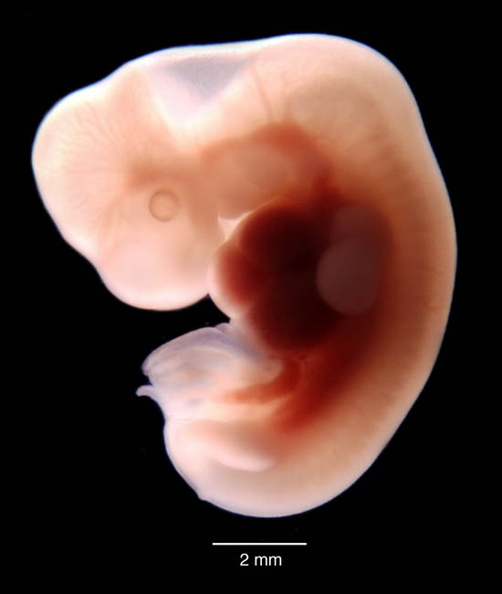 human embryo photograph