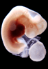 41 day human embryo - optical image