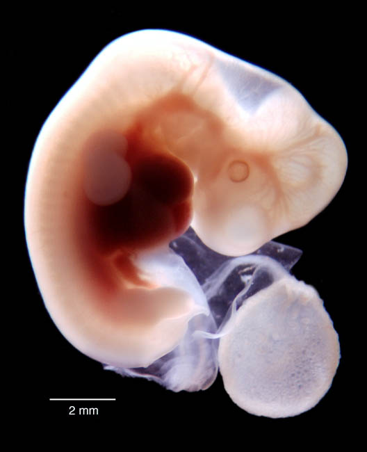 human embryo photograph