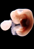 41 day human embryo - optical image