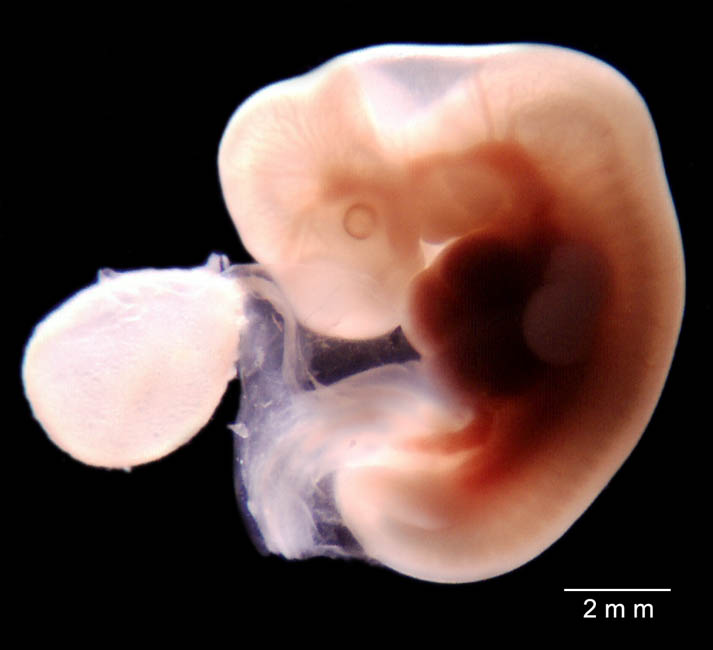 human embryo photograph