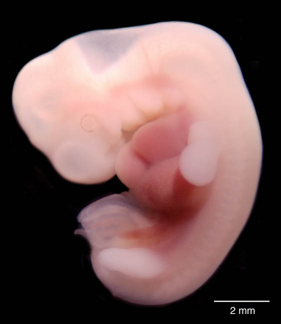 human embryo photograph