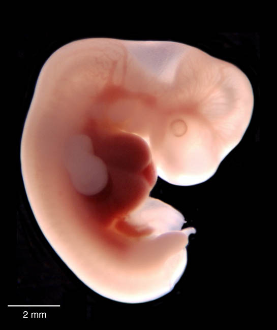 human embryo photograph