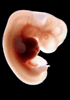 41 day human embryo - optical image