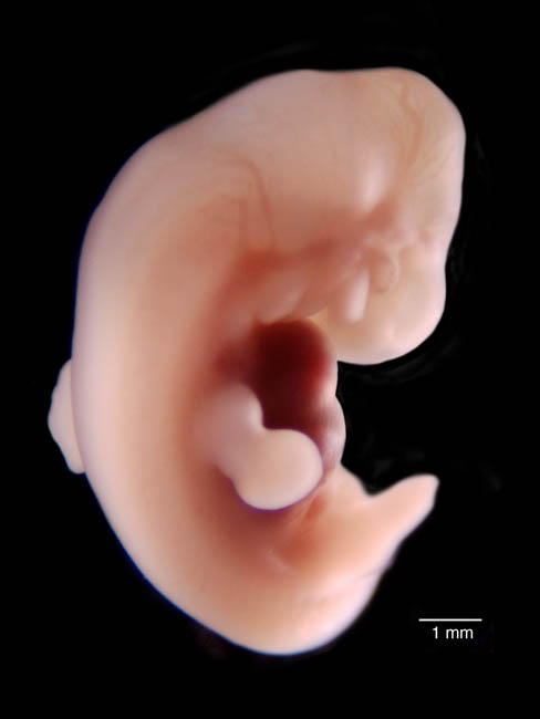 human embryo photograph