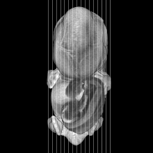 sagittal slice image map